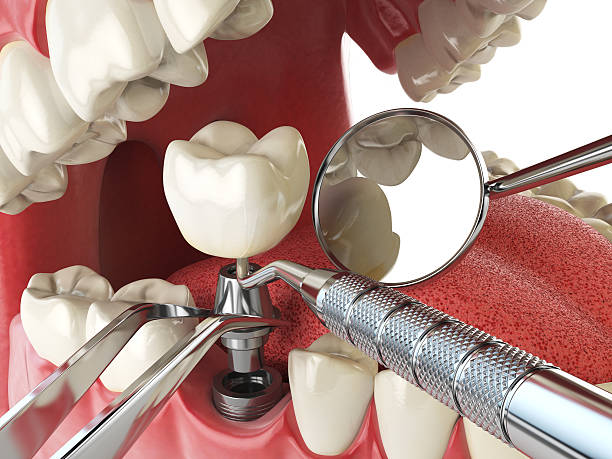 Best Pediatric Emergency Dentist in Landover Hills, MD